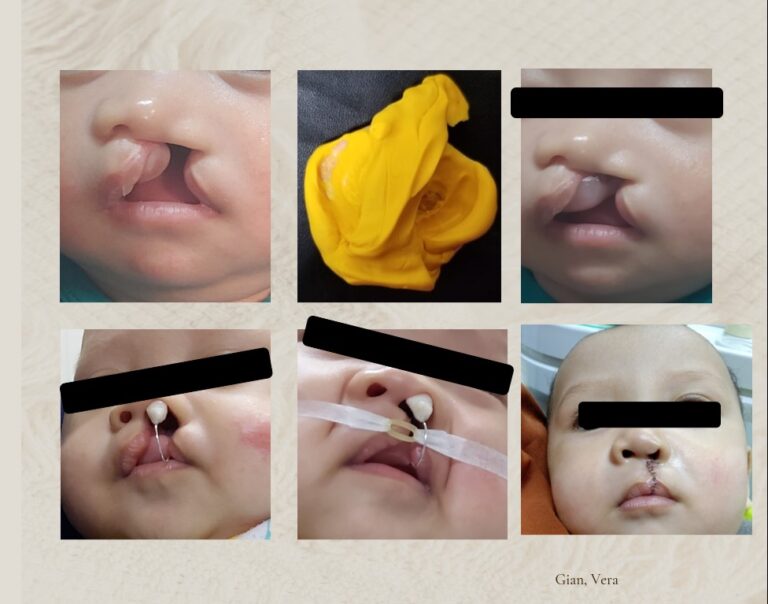 PNAM Bayi CBCL